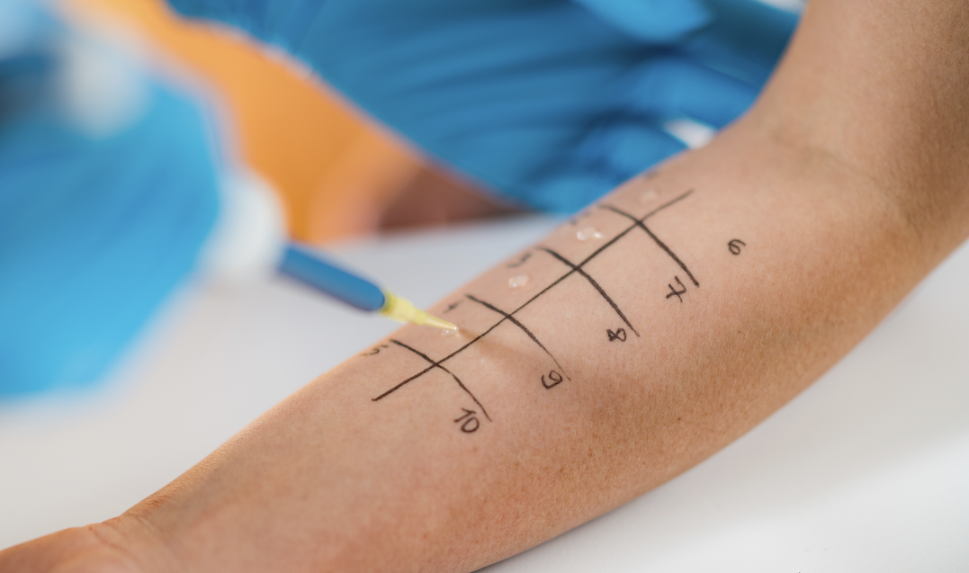 Food Allergy Testing and Diagnosing