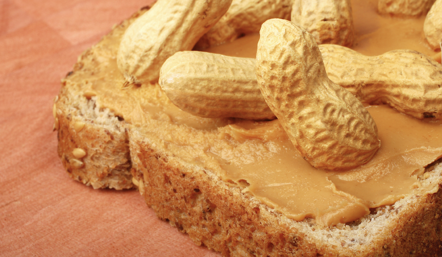 Living with a peanut allergy