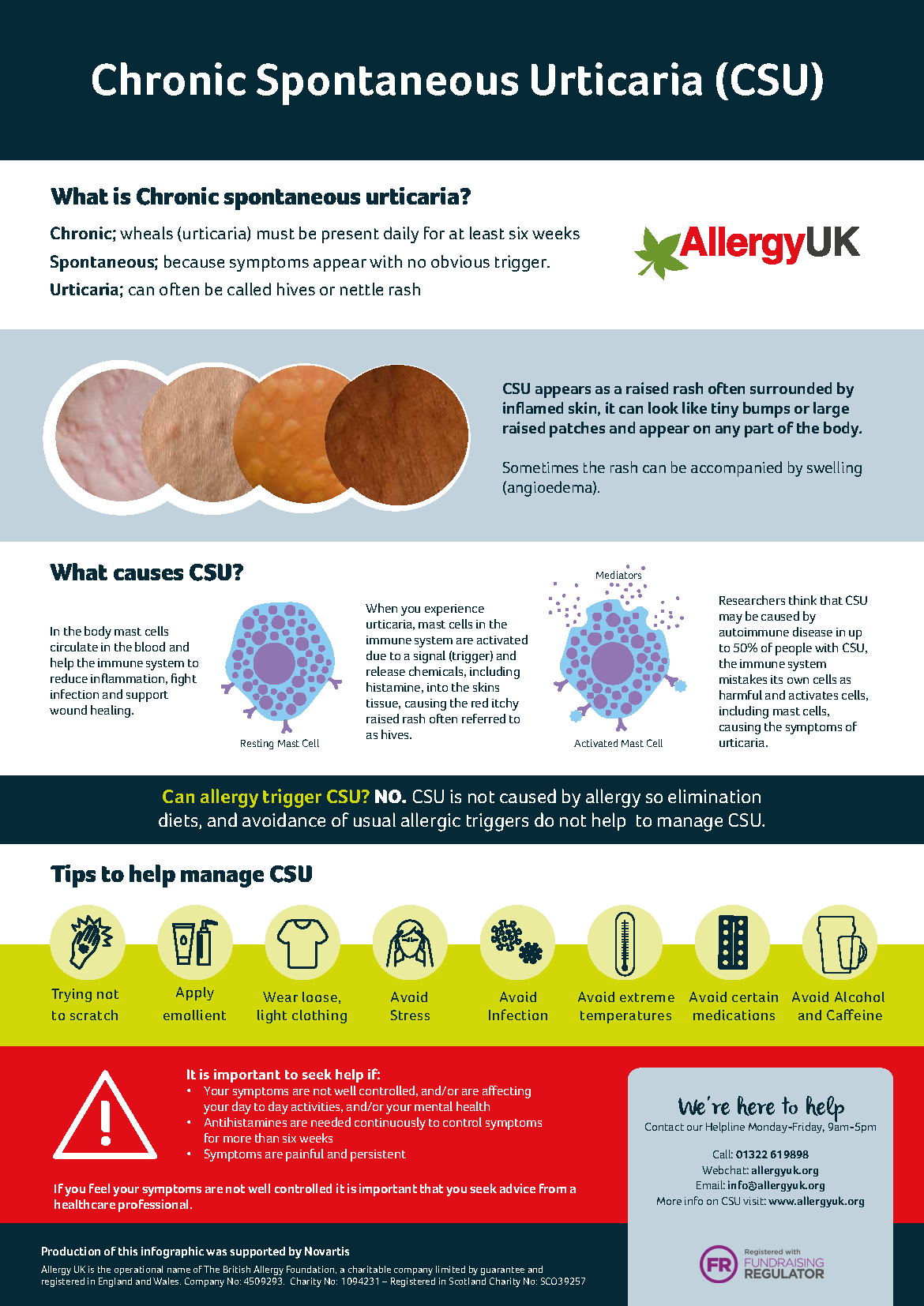 new research chronic urticaria