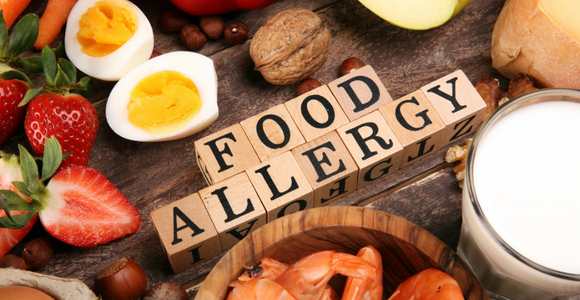 Living with a food allergy