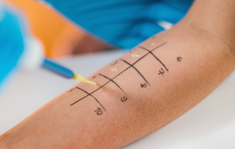 Food allergy testing and diagnosing