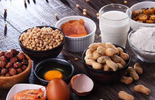 Living with a food allergy